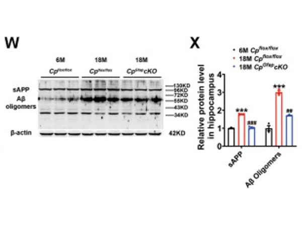 Western Blot using Aβ oligomer